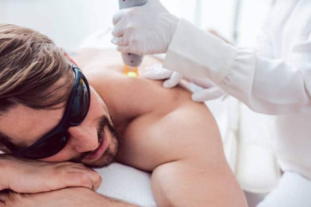 epliation-laser-my-laser