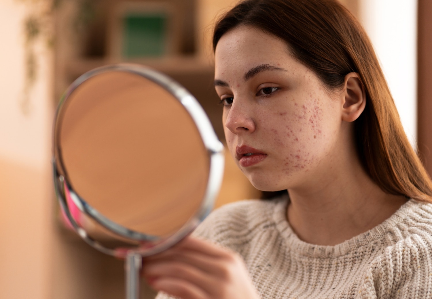 le traitement blemiderm