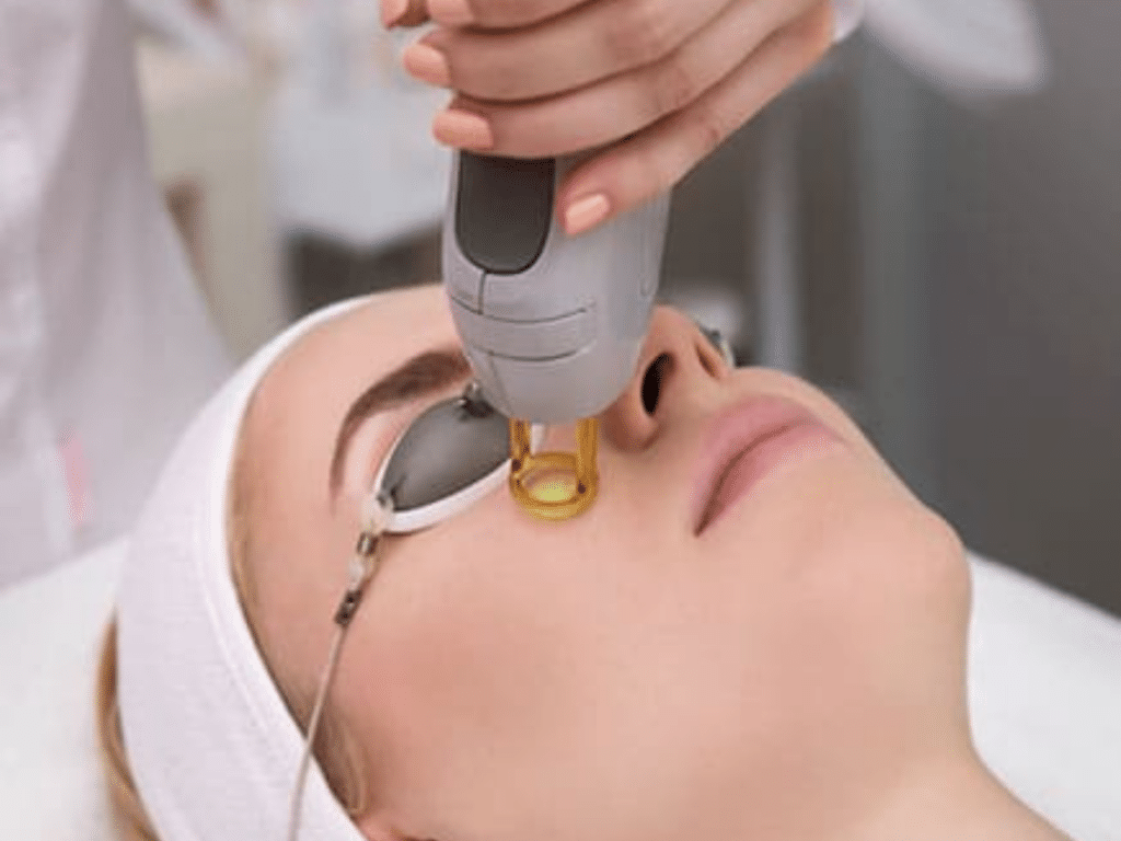 Épilation définitive du Visage : Ce que vous devez savoir