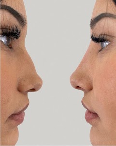 My Laser Lyon - Epilation laser & Médecine esthétique place picture