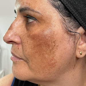 My Laser Center Saint-Denis - Epilation laser & Médecine esthétique place picture