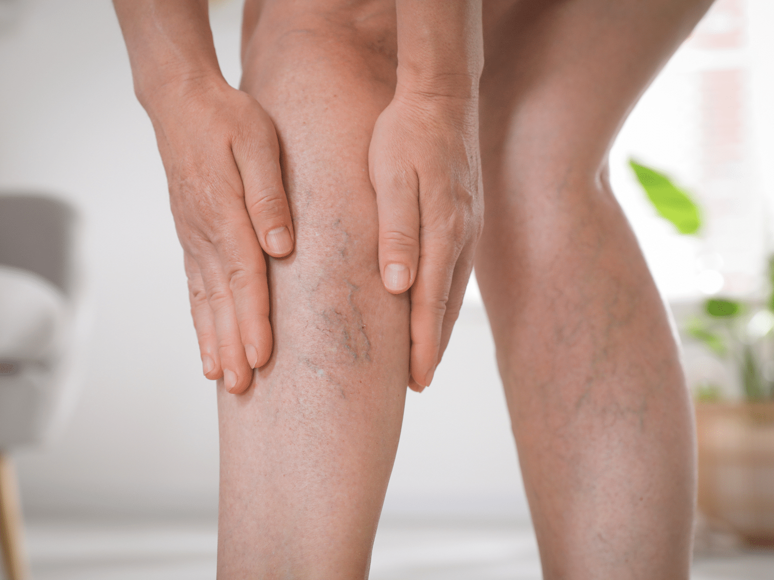 Laser Contre Varicosités : Solution Médical Pour Choisir Le Meilleur Traitement - My Laser