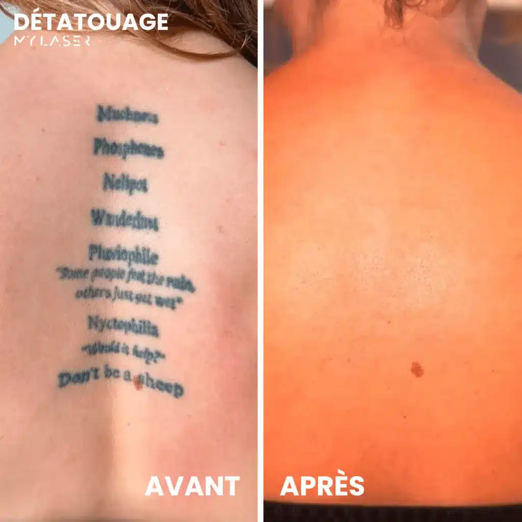 Long texte tatoué le long de la colonne vertébrale, puis dos sans inscription après les séances