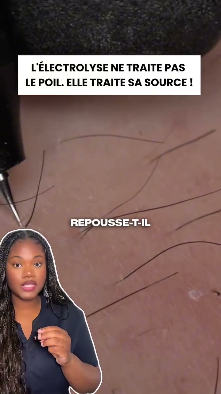 Vidéo My Laser : Pourquoi un poil traité par électrolyse ne repousse plus