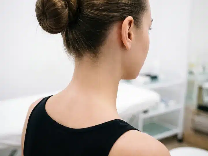 Nuque et cou d'une femme aux cheveux relevés, peau nette après épilation laser chez My Laser