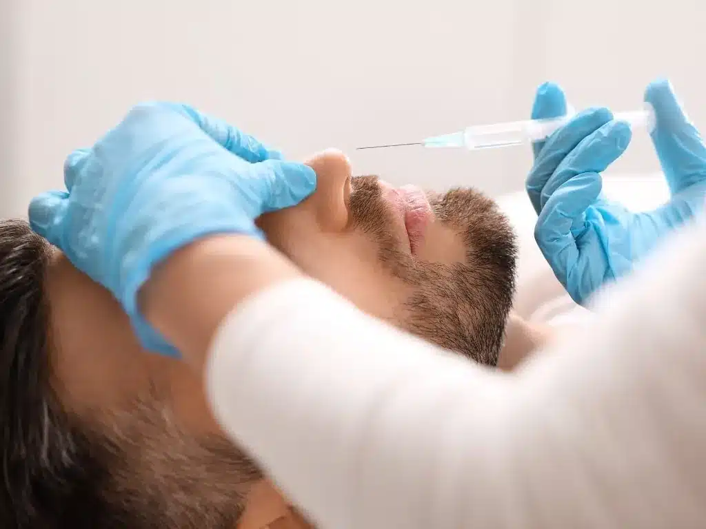 Rhinoplastie médicale à l'acide hyaluronique : injection sur l'arête du nez d'un homme allongé, mains gantées de bleu