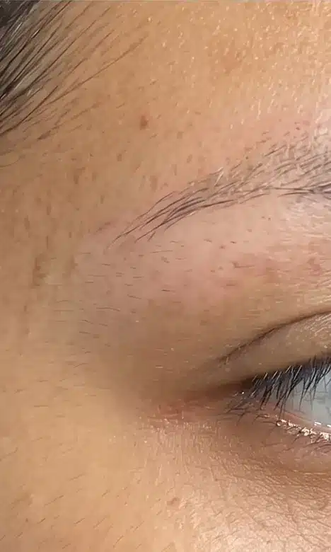 Maquillage permanent du sourcil estompé après le détatouage laser chez My Laser