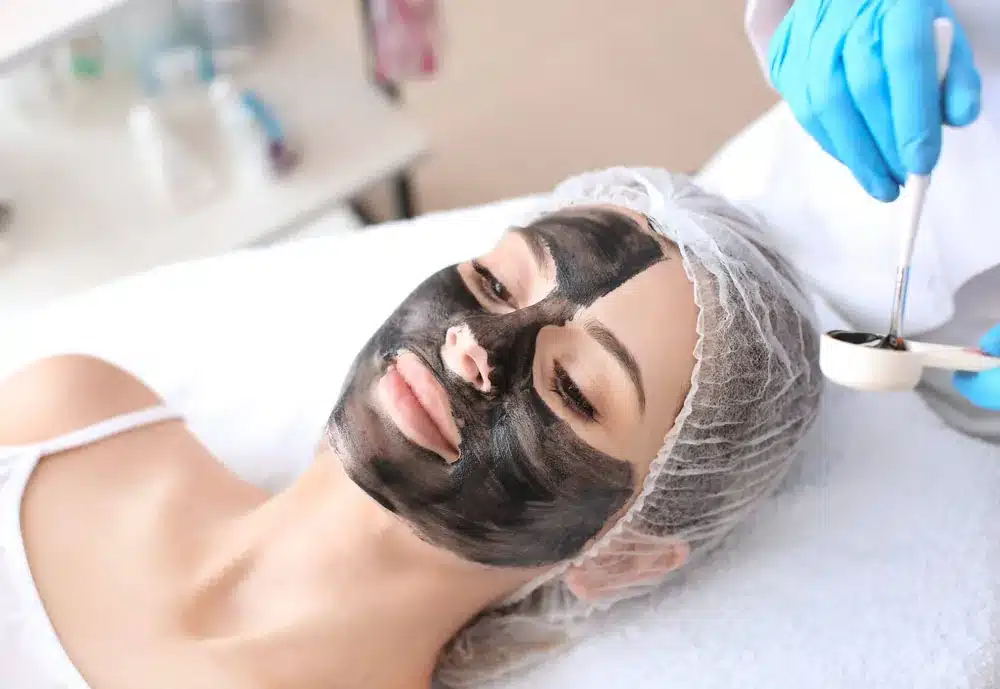 Carbon peel au laser chez My Laser Bordeaux