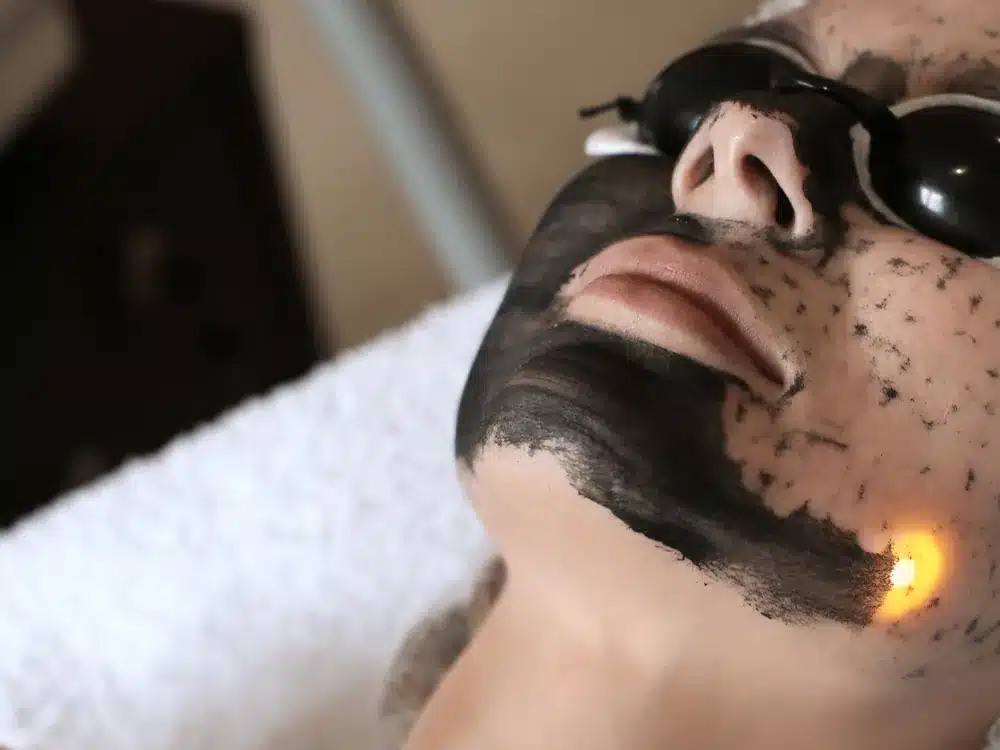 Passage du laser sur un masque au carbone, patiente protégée par des lunettes