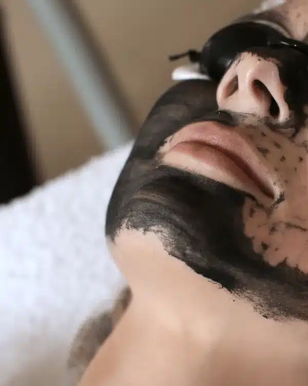 Soin du visage et peeling chez My Laser