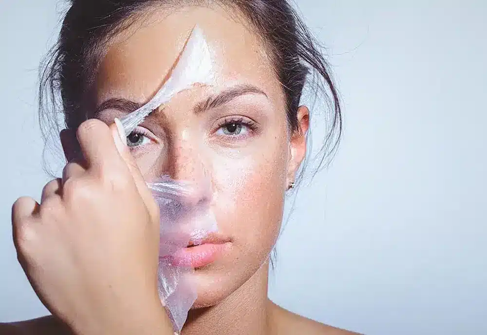 Peeling du visage chez My Laser Bordeaux