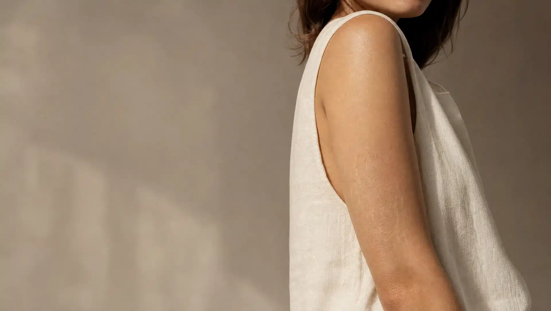 Haut du bras d'une femme à la peau beige chaud, fines vergetures argentées à l'arrière du bras, haut sans manches en lin ivoire, visage en partie hors cadre