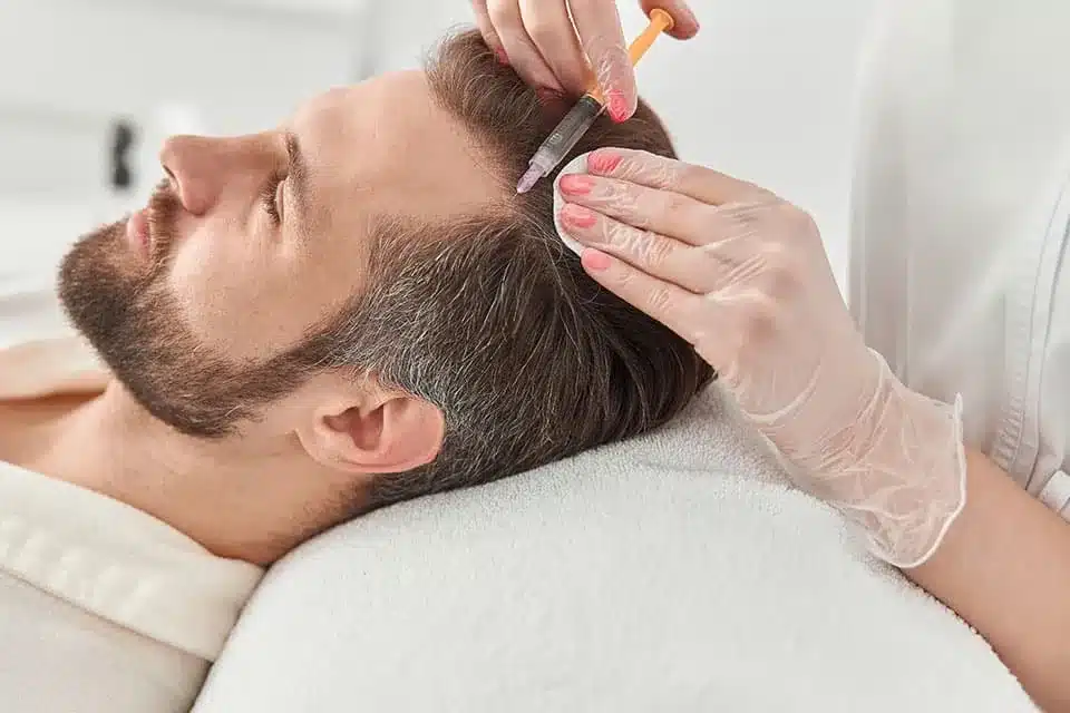Injections dans le cuir chevelu d'un homme allongé, réalisées à la seringue par des mains gantées
