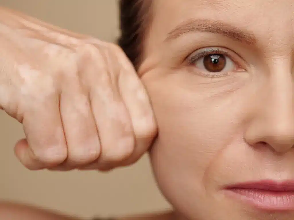 Visage d'une femme en gros plan, le poing contre la tempe tend la peau autour de l'œil