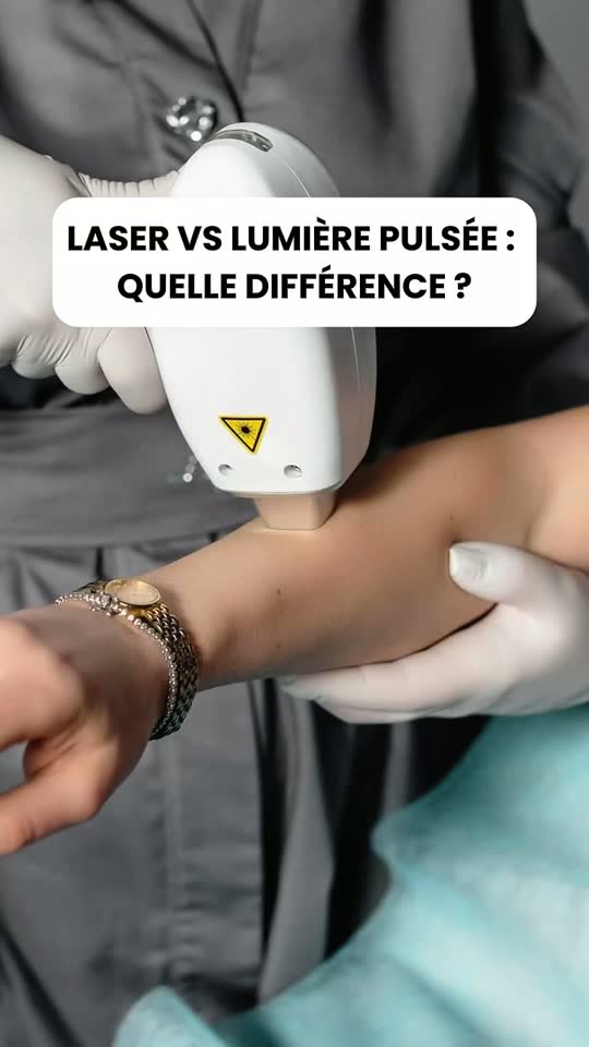 Vidéo My Laser : Laser ou lumière pulsée (IPL) : quelle est vraiment la différence ?